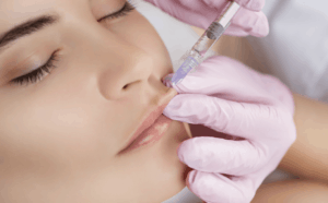 Botox is injected into the upper lip to achieve the perfect lip flip.