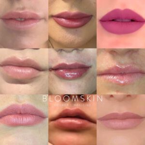 Lip treatments