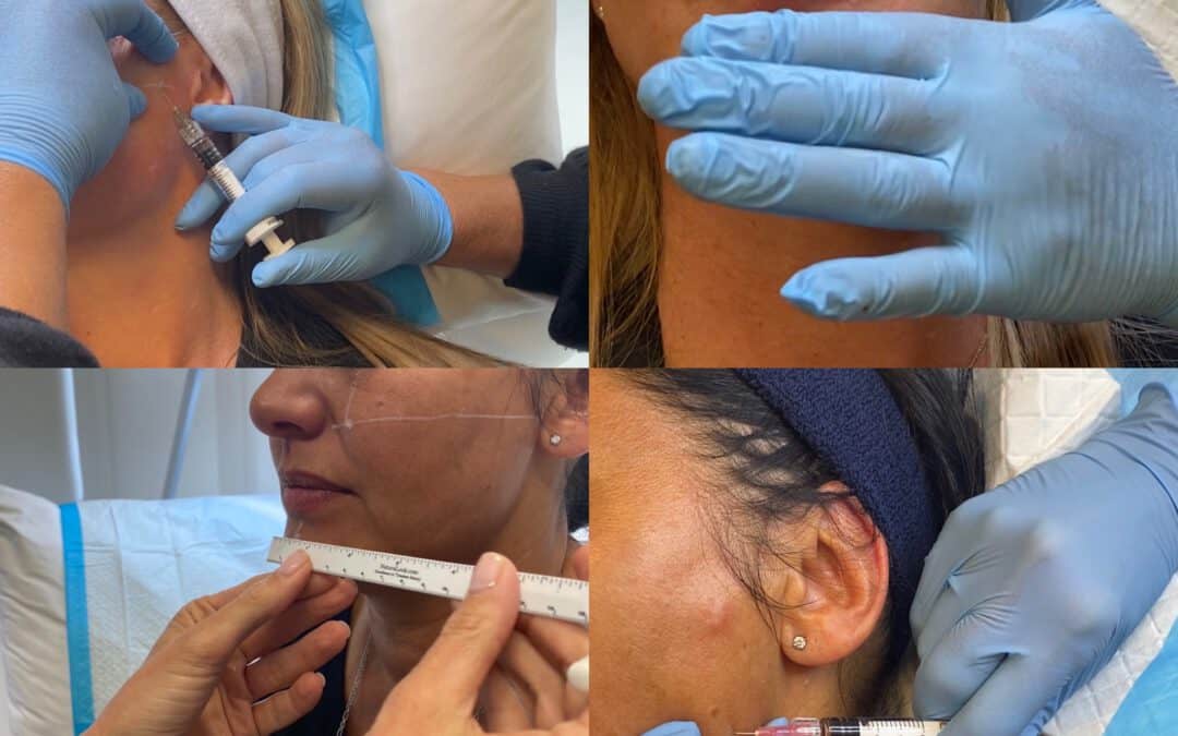 Image shows a Profhilo treatment in action